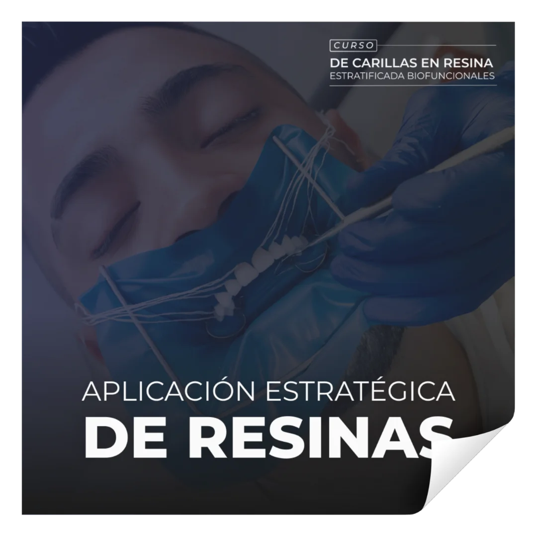 Aplicación de resinas